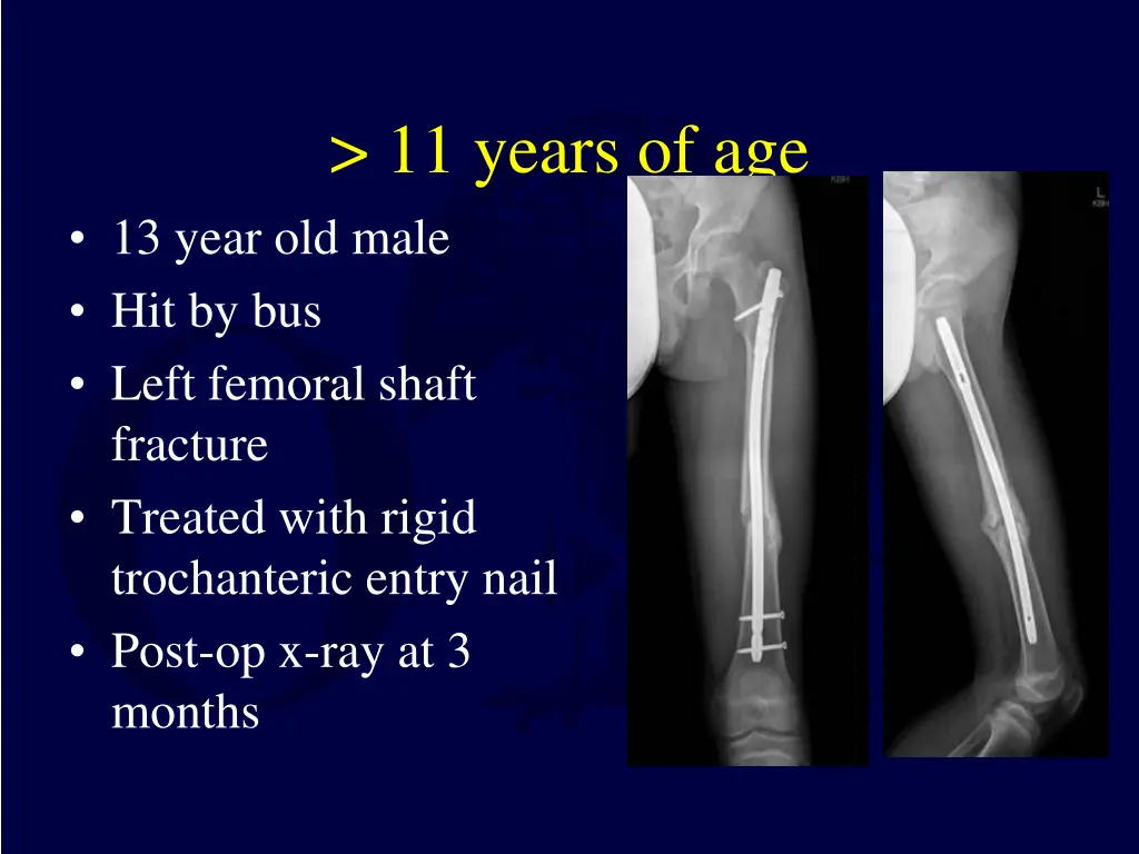 11 years of age 1