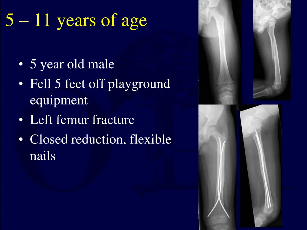 5 11 years of age 2