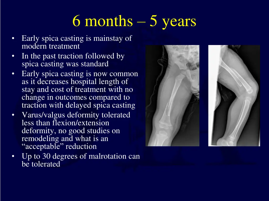 6 months 5 years early spica casting is mainstay