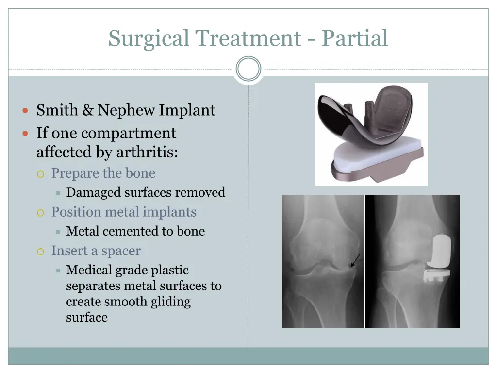 surgical treatment partial