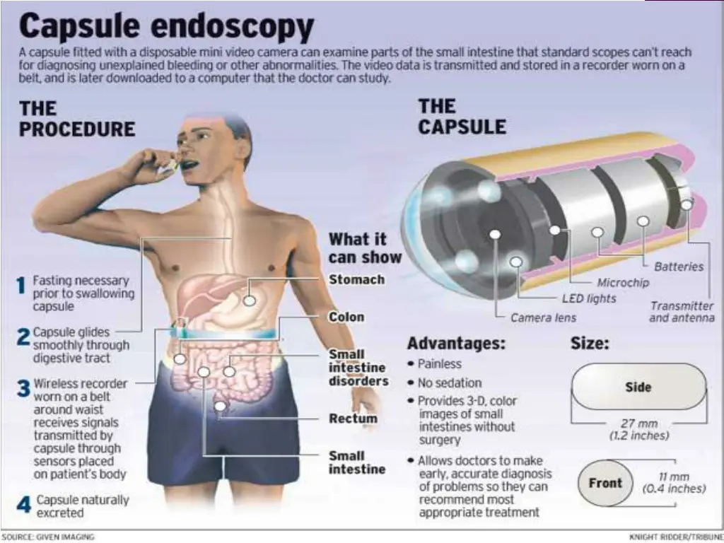 slide23