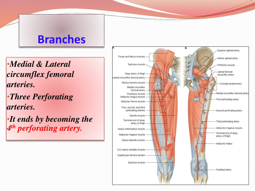 branches