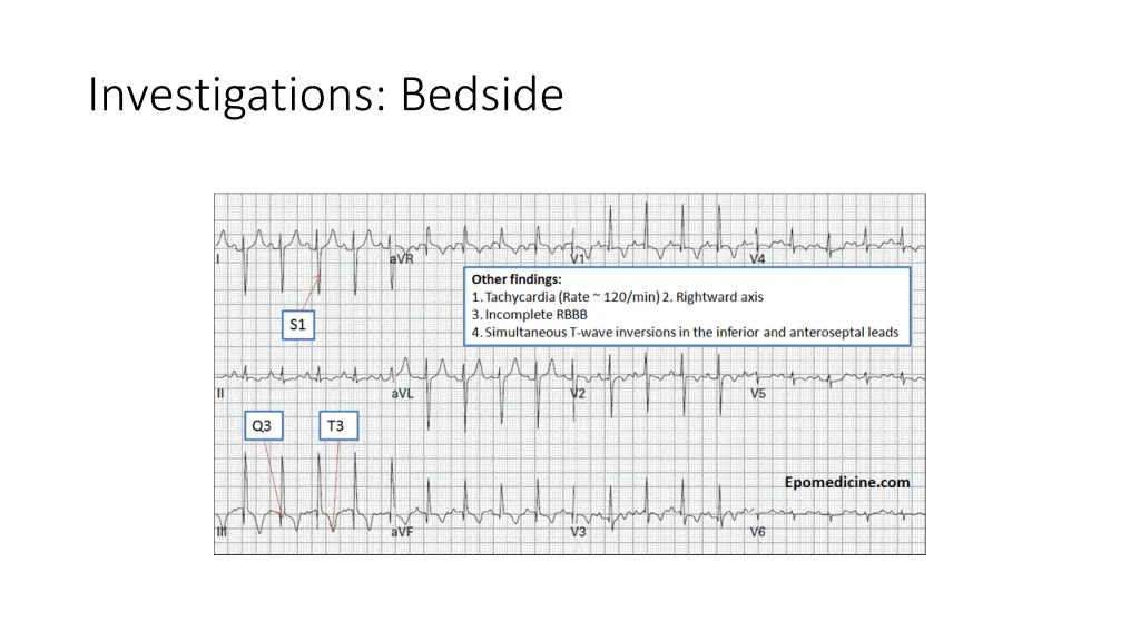 investigations bedside 1