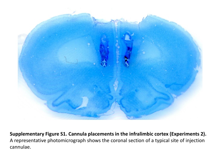 supplementary figure s1 cannula placements