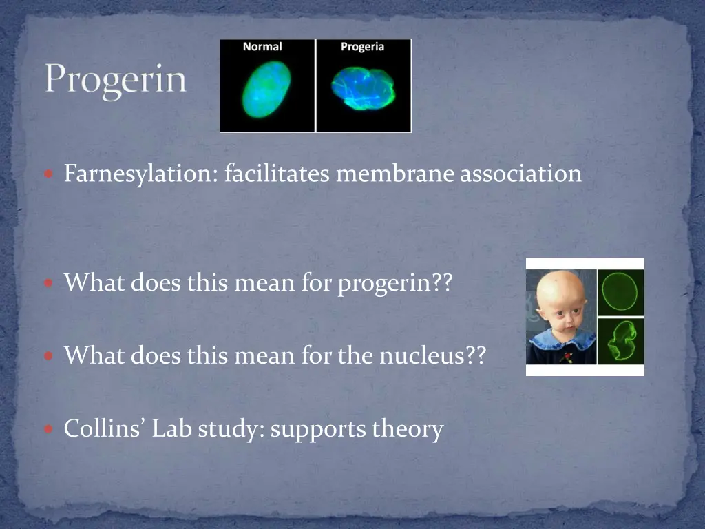 progerin 1