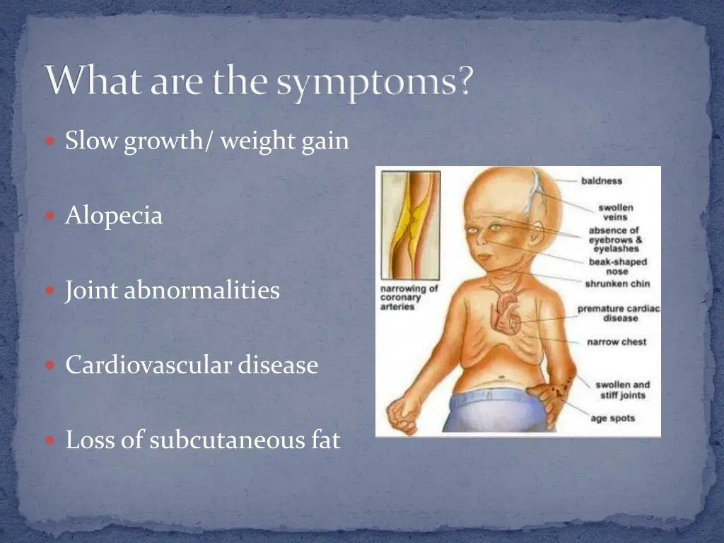 what are the symptoms