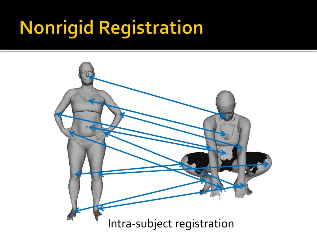 intra subject registration