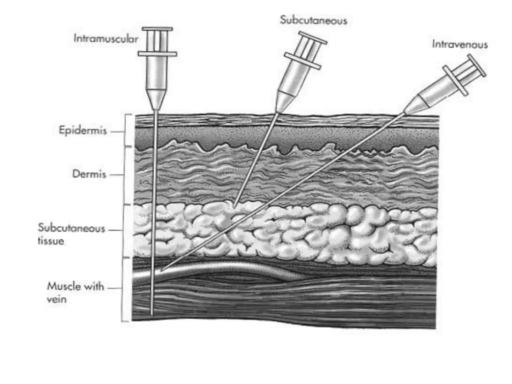 slide6