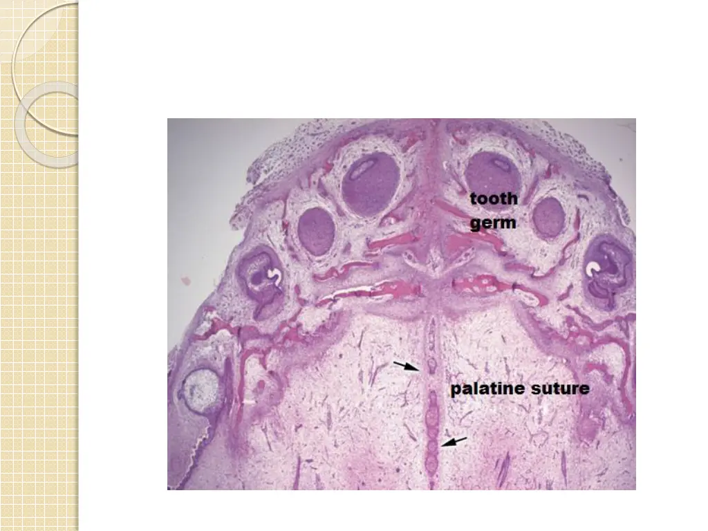 slide11