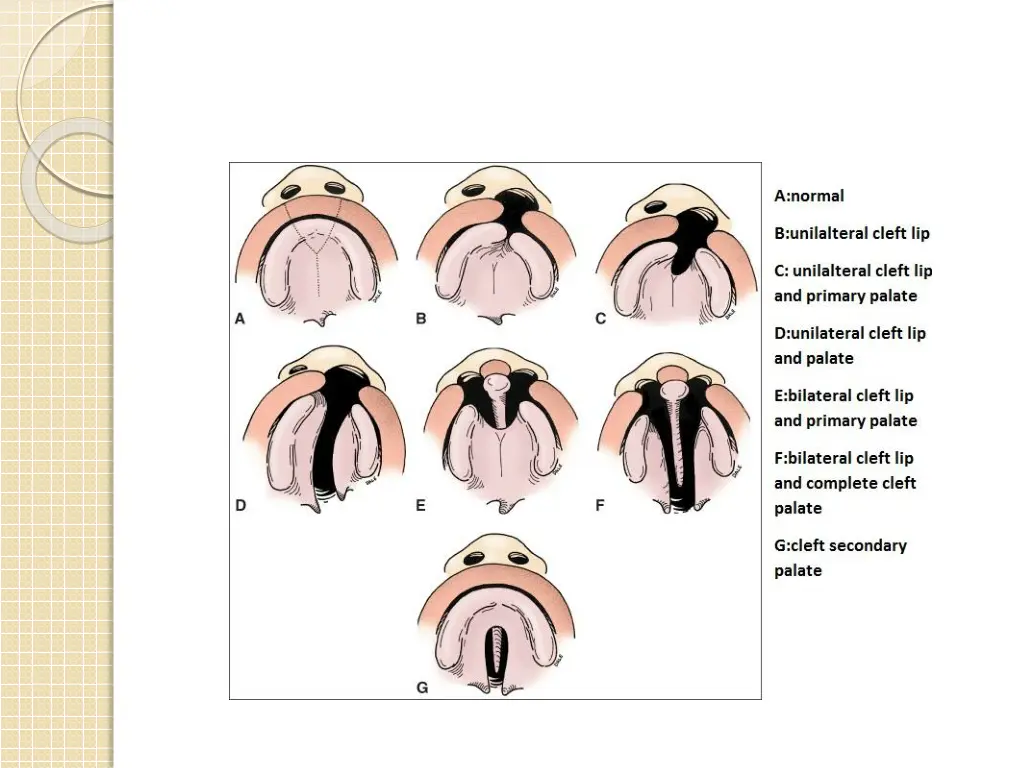 slide12