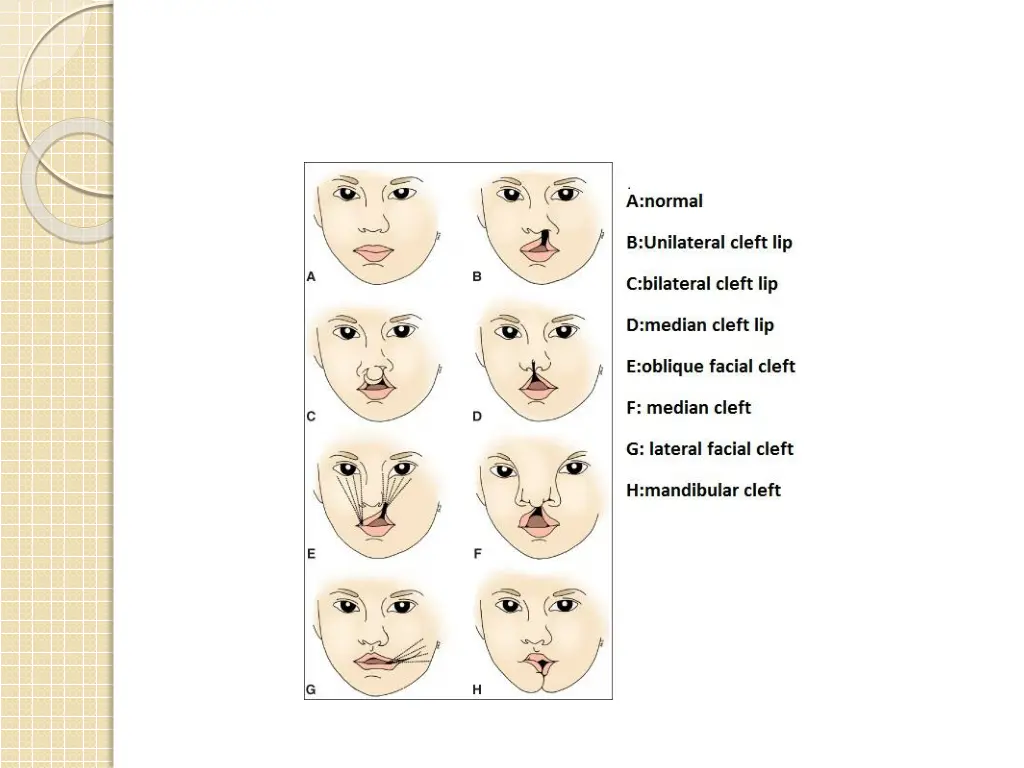 slide14