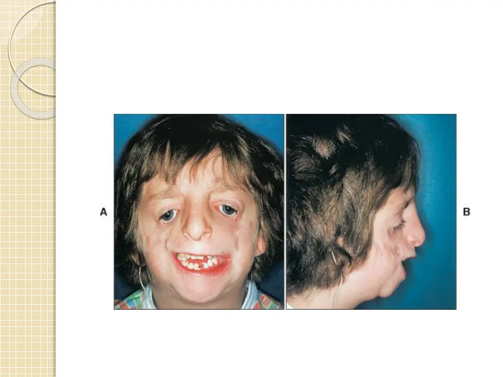 slide17