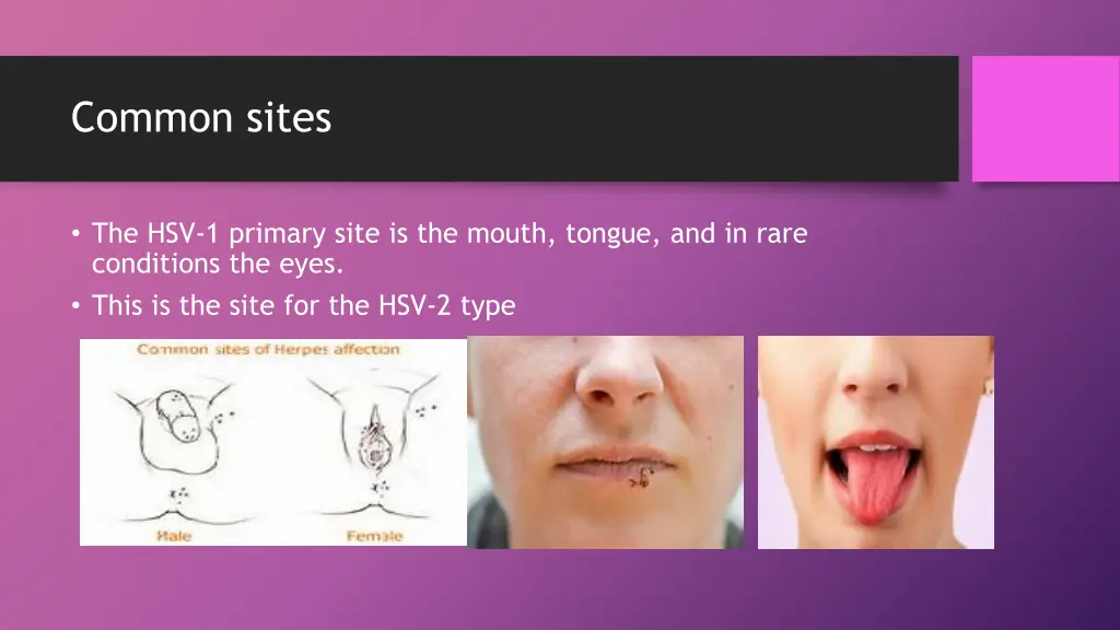 common sites