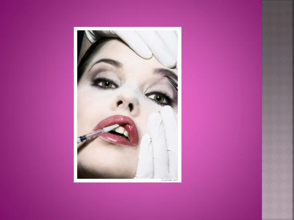 slide16