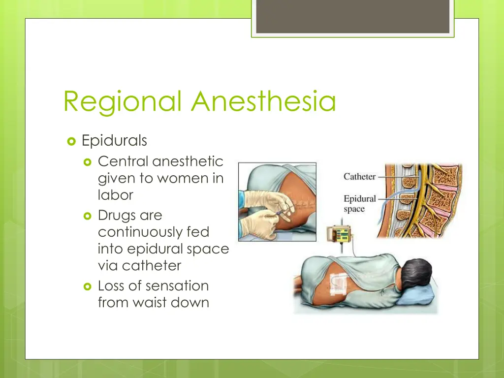 regional anesthesia 1
