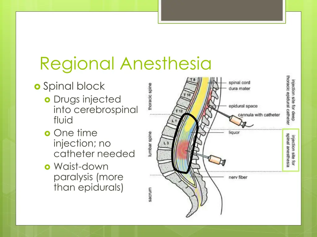 regional anesthesia 2