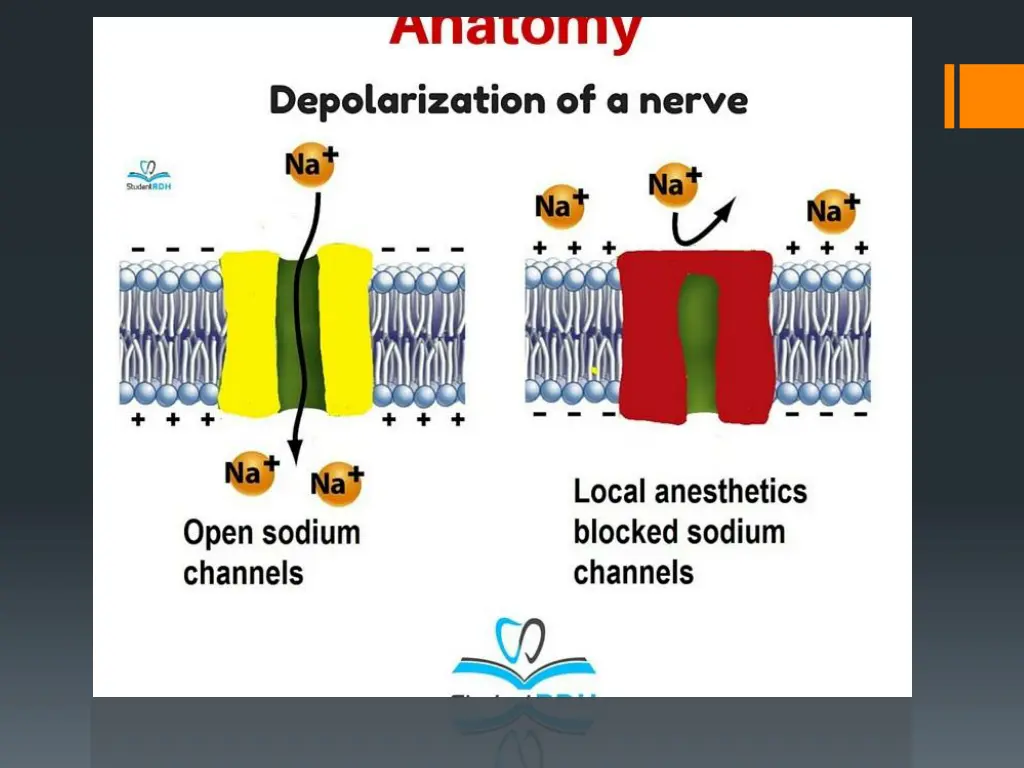 slide12