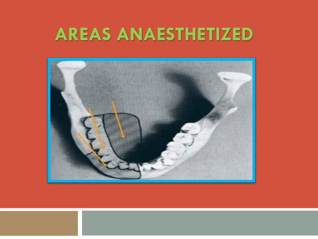 areas anaesthetized