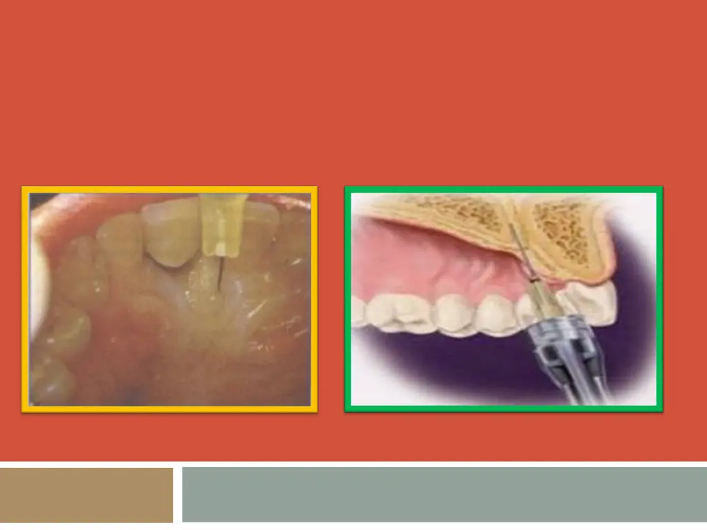 slide3