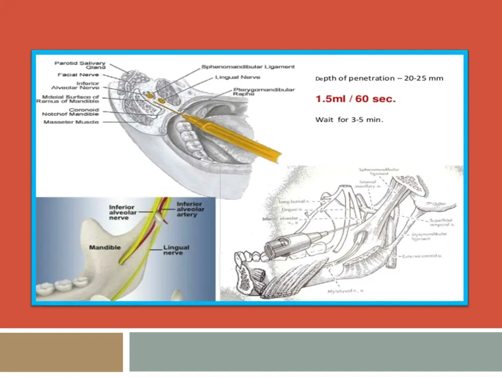 slide4