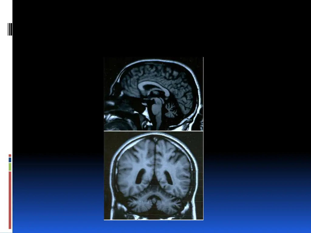 slide5