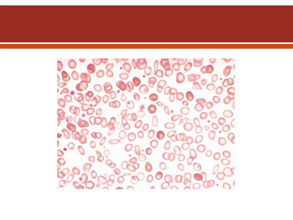slide38