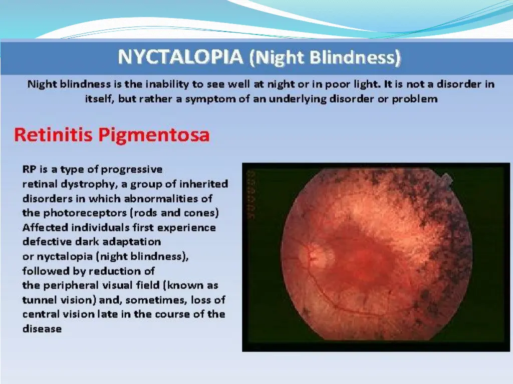 slide25