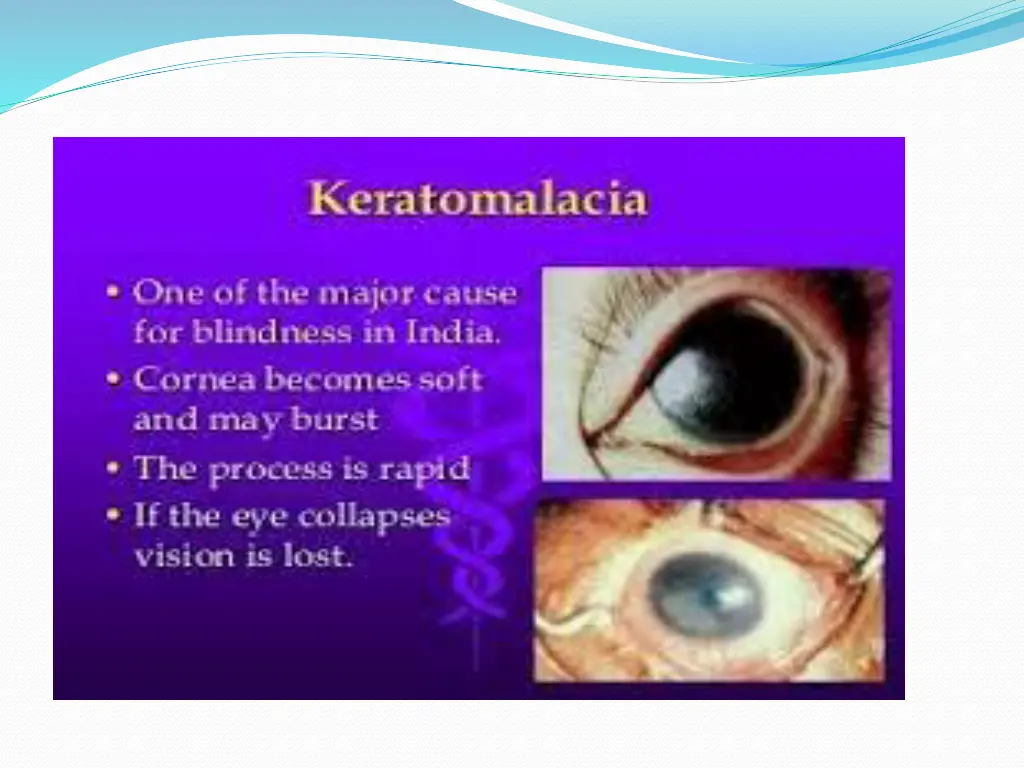 slide26
