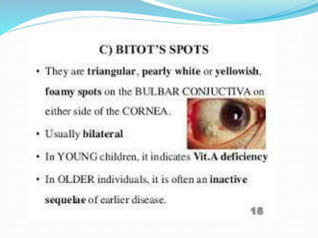 slide27