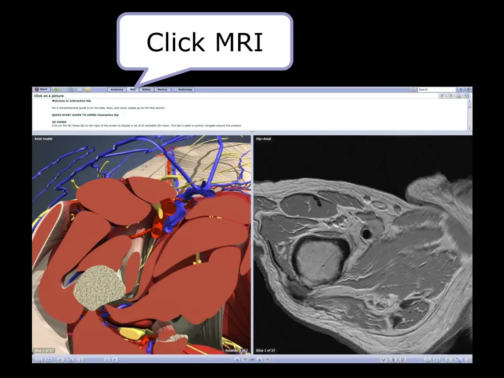 click mri
