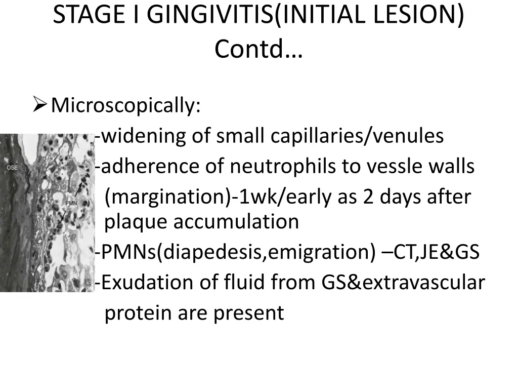 stage i gingivitis initial lesion contd