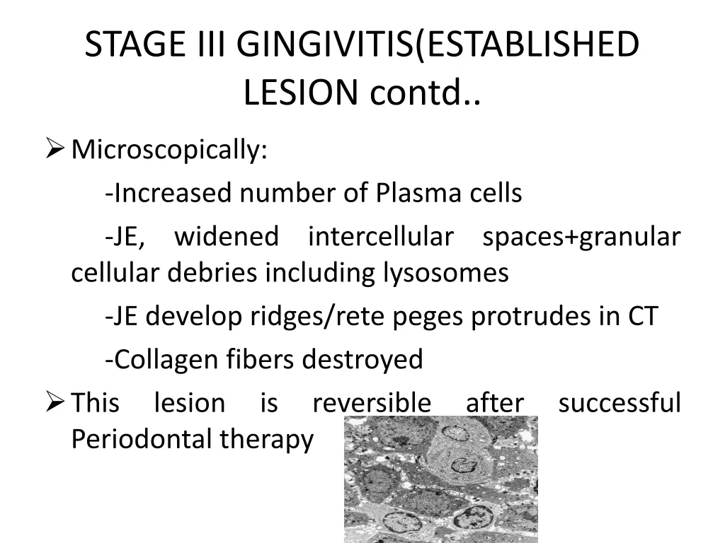 stage iii gingivitis established lesion contd 1