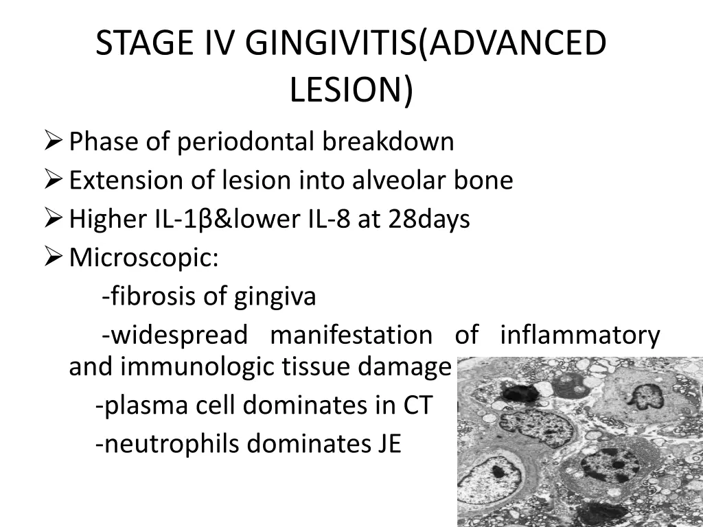 stage iv gingivitis advanced lesion phase