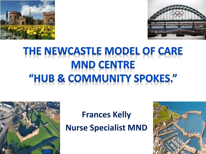 the newcastle model of care mnd centre