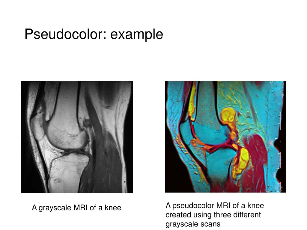 pseudocolor example