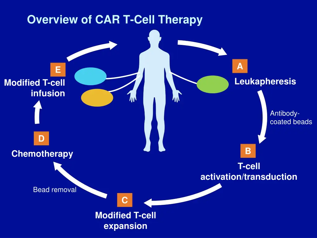 overview of car t cell therapy