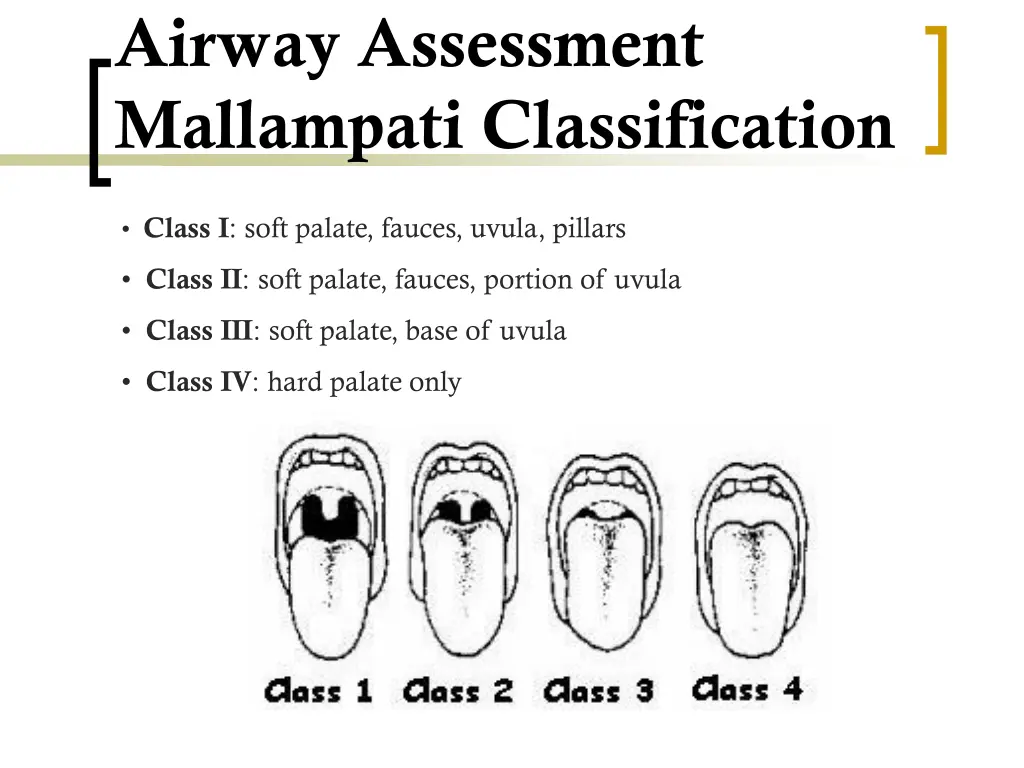 airway assessment mallampati classification