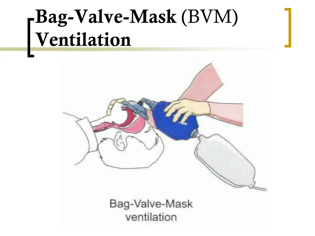 bag valve mask bvm ventilation