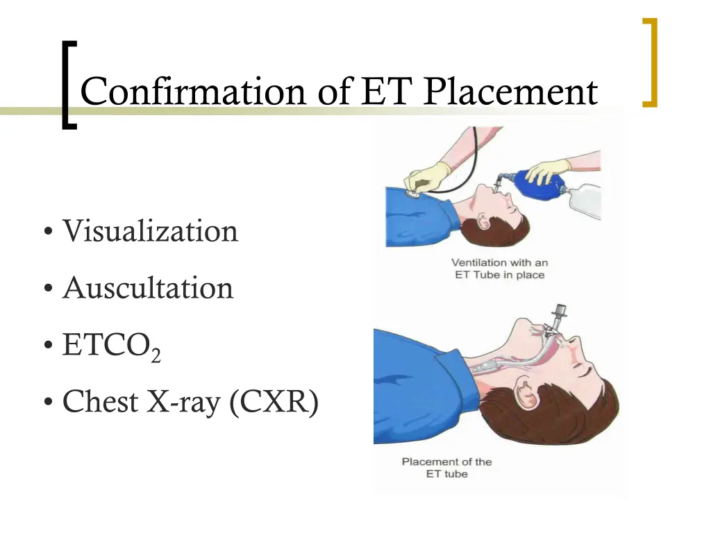 confirmation of et placement
