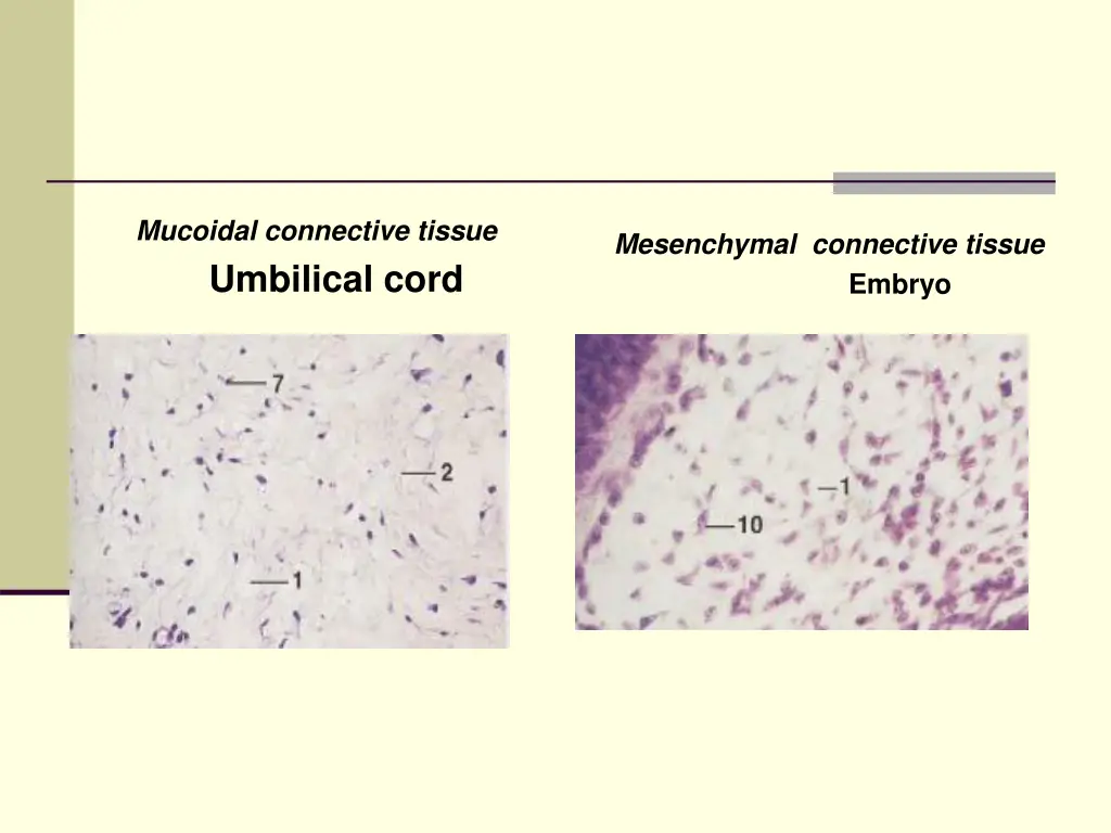 mucoidal connective tissue umbilical cord