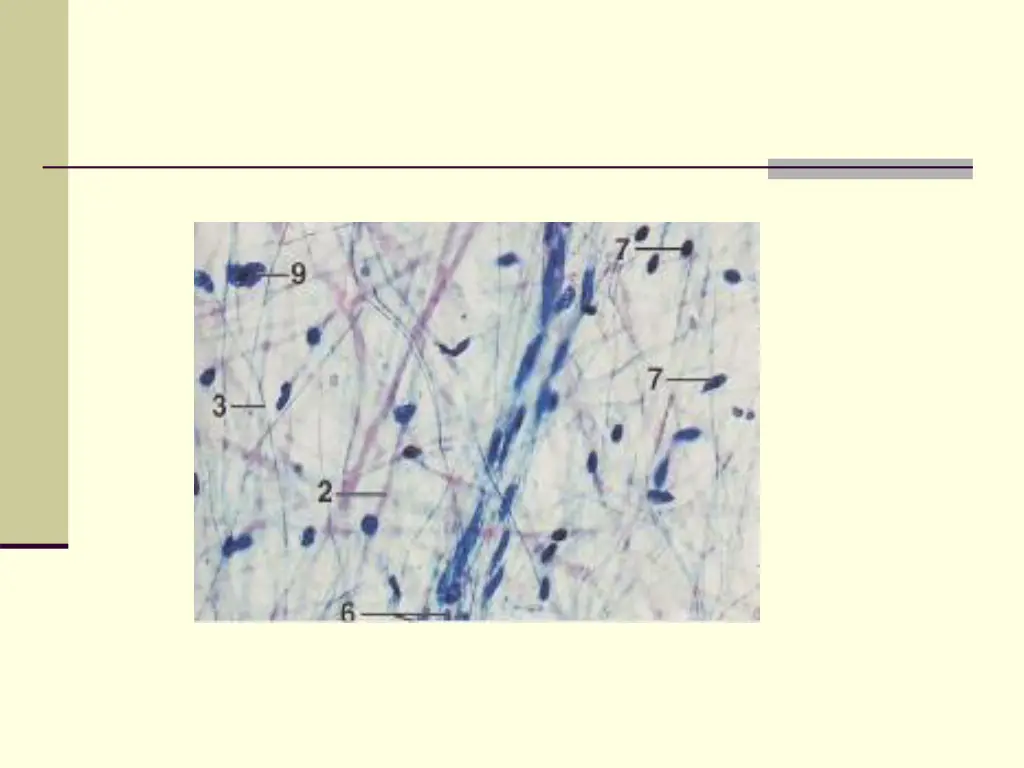 slide16