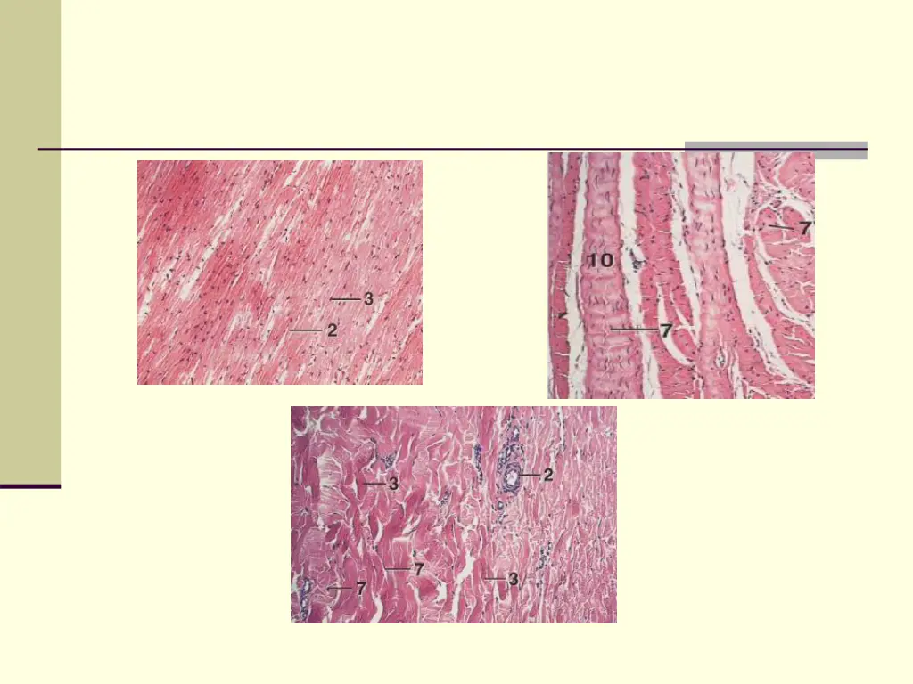 slide21