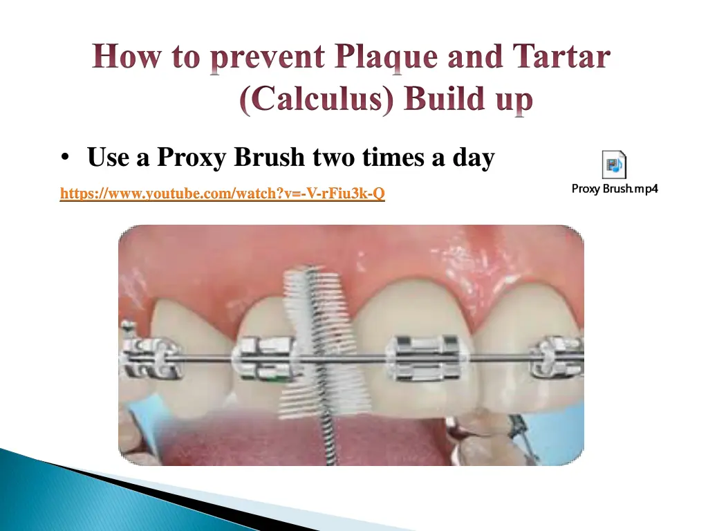 how to prevent plaque and tartar calculus build up