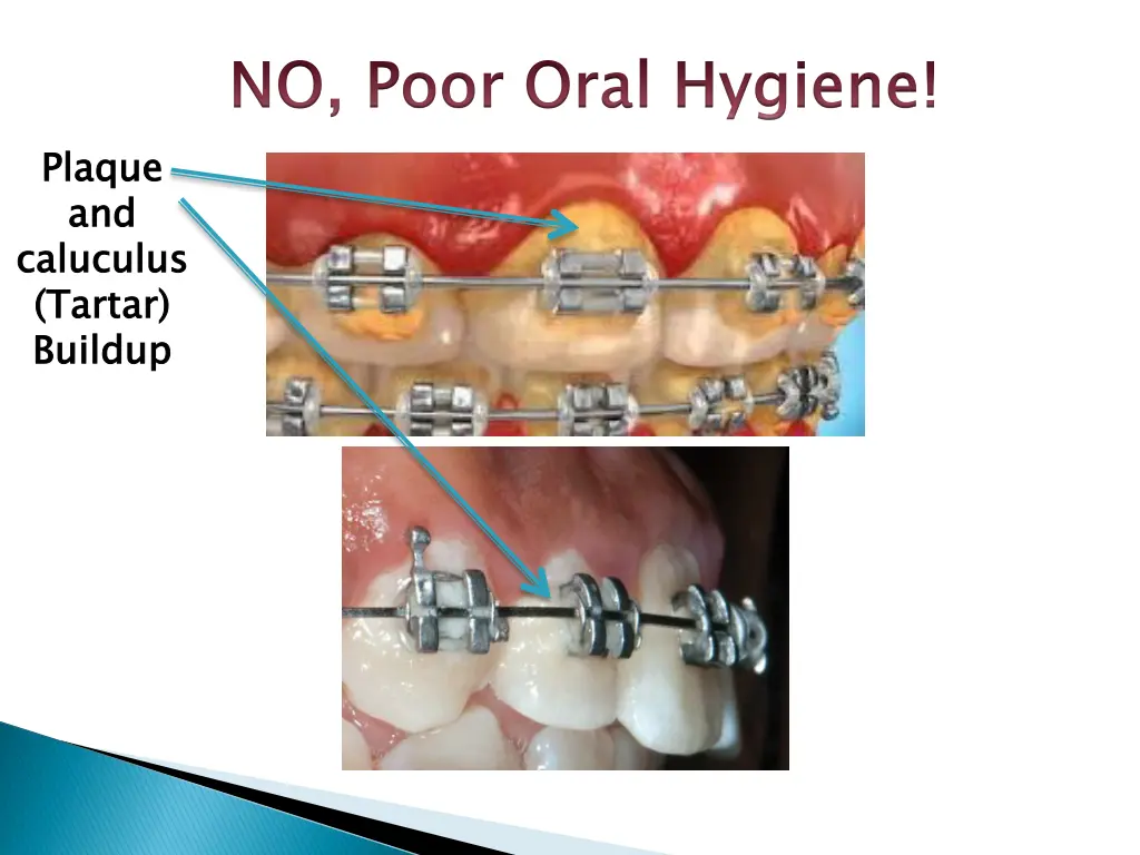 no poor oral hygiene