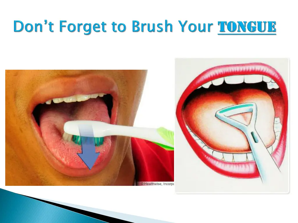 slide12