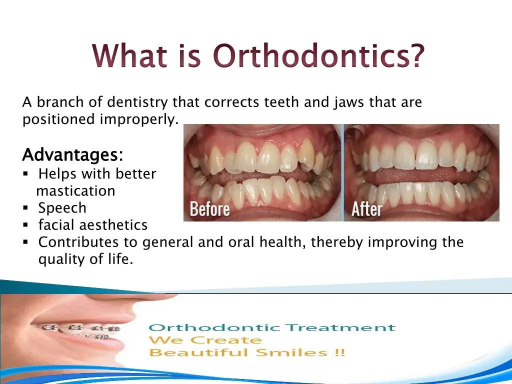 slide3