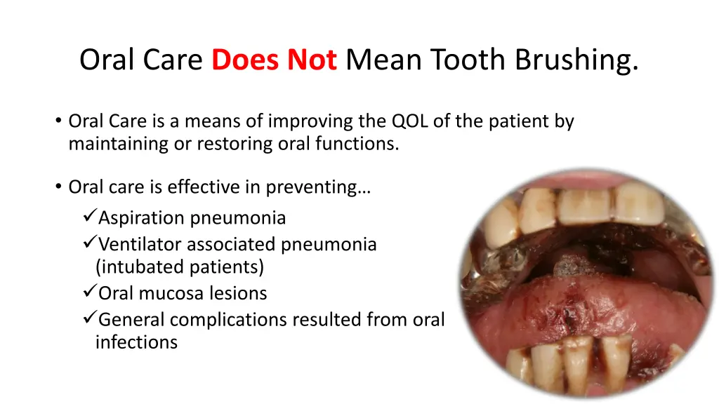 oral care does not mean tooth brushing
