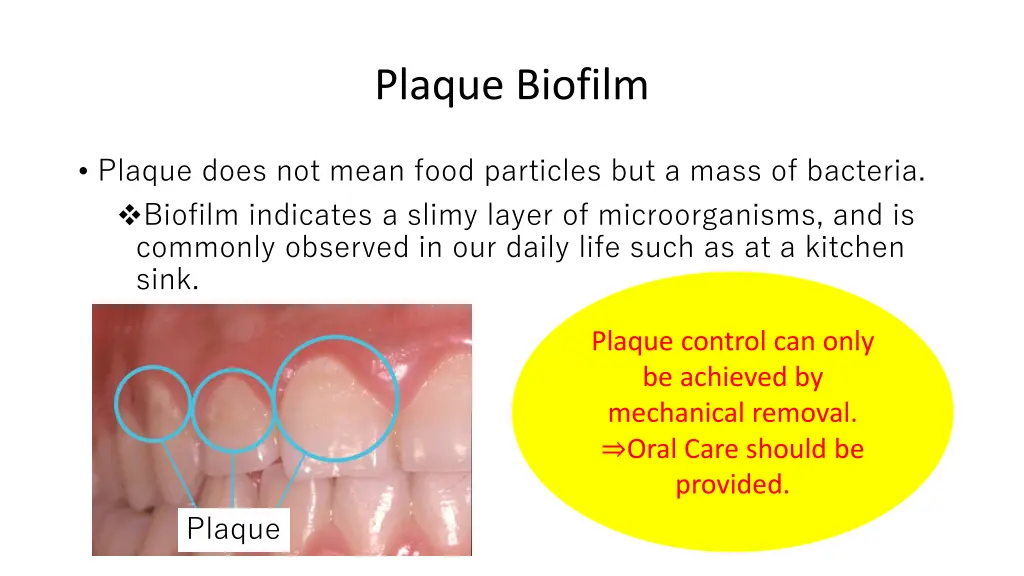 plaque biofilm