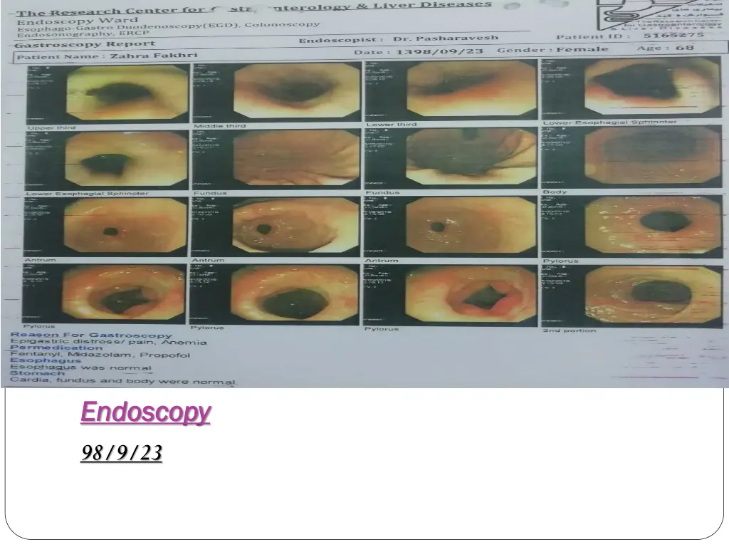 endoscopy endoscopy