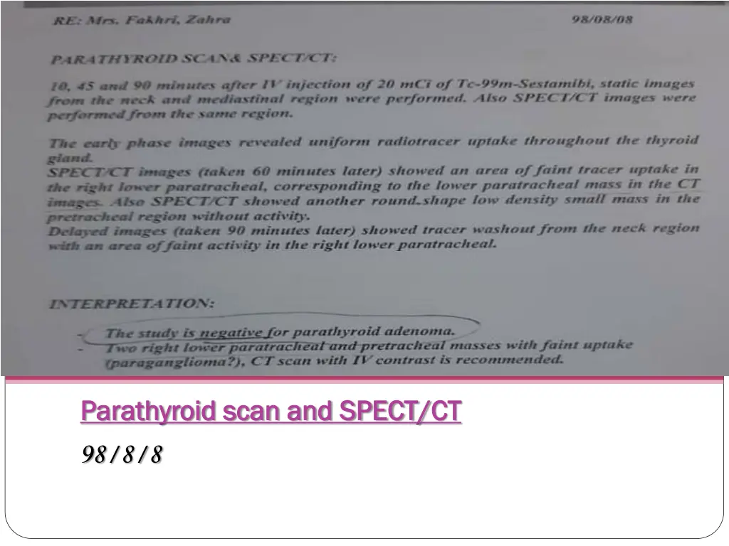 parathyroid scan and spect parathyroid scan